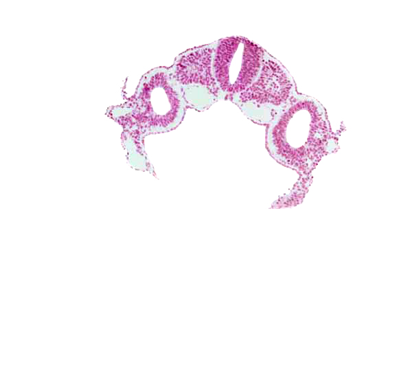 alar plate(s), basal plate, floor plate, left umbilical vein, left vitelline (omphalomesenteric) vein, midgut, peritoneal cavity (coelom), right umbilical vein, right vitelline (omphalomesenteric) vein, roof plate, sclerotome, somitocoel 4, sulcus limitans, surface ectoderm, umbilical vesicle wall