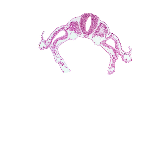 amnion attachment, dermatomyotome 6 (C-2), lateral body fold, left umbilical vein, right umbilical vein, sclerotome, somitocoel 6