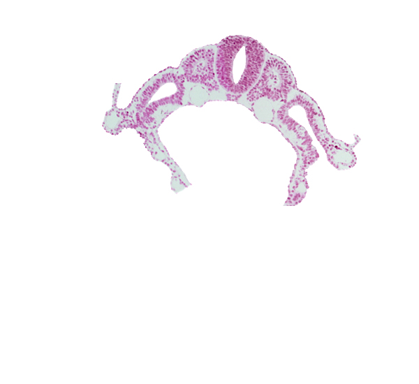 communication between peritoneal cavity and extra-embryonic coelom, dermatomyotome 6 (C-2), dorsal aorta, endoderm, midgut, notochord, somitocoel 6, spinal part of neural tube, surface ectoderm