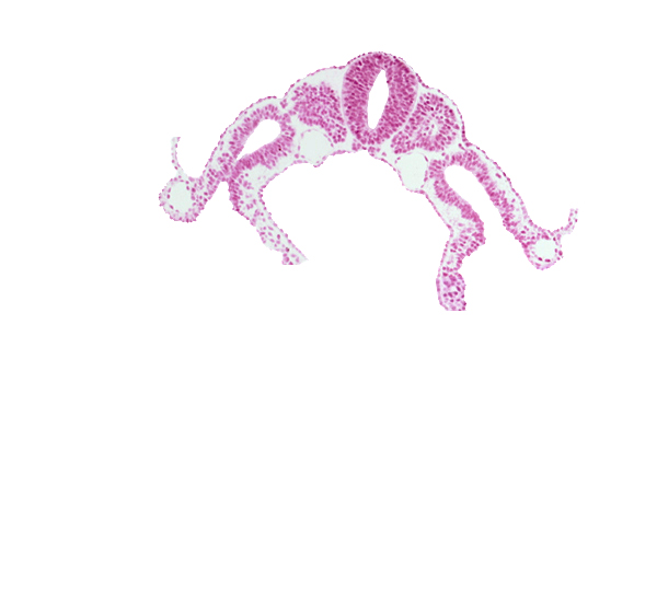 amnion attachment, amniotic cavity, communication between peritoneal cavity and extra-embryonic coelom, dermatomyotome 7 (C-3), extra-embryonic coelom, sclerotome, somitocoel 7, umbilical vesicle cavity