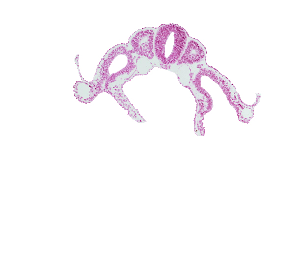 communication between peritoneal cavity and extra-embryonic coelom, dermatomyotome 7 (C-3), neural tube, right umbilical vein, sclerotome, somitocoel 7, surface ectoderm