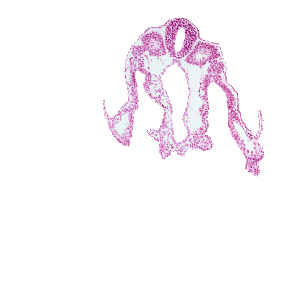 caudal part of umbilical vesicle cavity, dorsal aorta, extra-embryonic ectoderm, extra-embryonic endoderm, extra-embryonic mesoderm, hindgut, lateral body fold, notochord, right umbilical vein, somite 11 (C-7), somitocoel 11