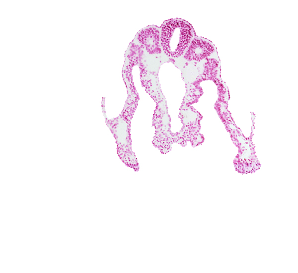 dorsal aorta, intermediate mesenchyme, lateral body fold, midgut, notochord, right umbilical vein, somite 11 (C-7), somitocoel 11