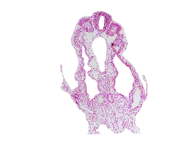 allantois, amnion attachment, amniotic cavity, connecting stalk mesenchyme, hindgut, left umbilical vein, peritoneal cavity (coelom), right umbilical artery, right umbilical vein, somite 12 (C-8), somitocoel 12