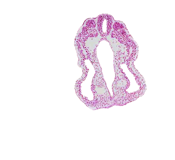 caudal part of somite 13 (T-1), endoderm, hindgut, left umbilical artery, lumen of neural tube, peritoneal cavity (coelom), right umbilical artery