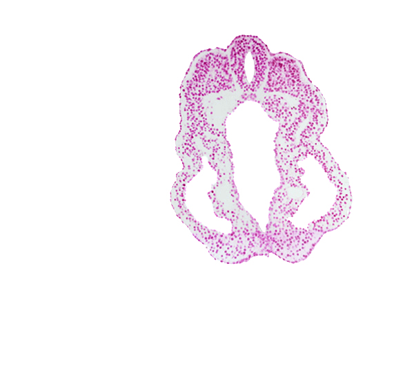 cloacal membrane, cloacal part of hindgut, dorsal aorta, notochord, paraxial mesoderm, peritoneal cavity (coelom), spinal part of neural tube, surface ectoderm