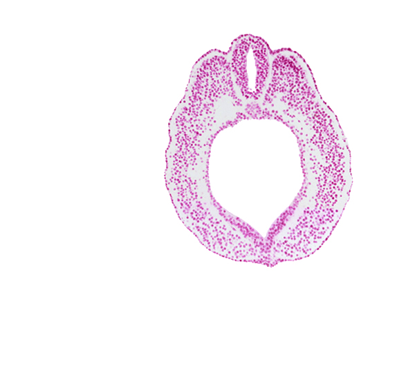 caudal edge of cloacal membrane, cloacal part of hindgut, dorsal aorta, dorsal aorta plexus, endoderm, lateral mesoderm, notochord, paraxial mesoderm, spinal part of neural tube, surface ectoderm