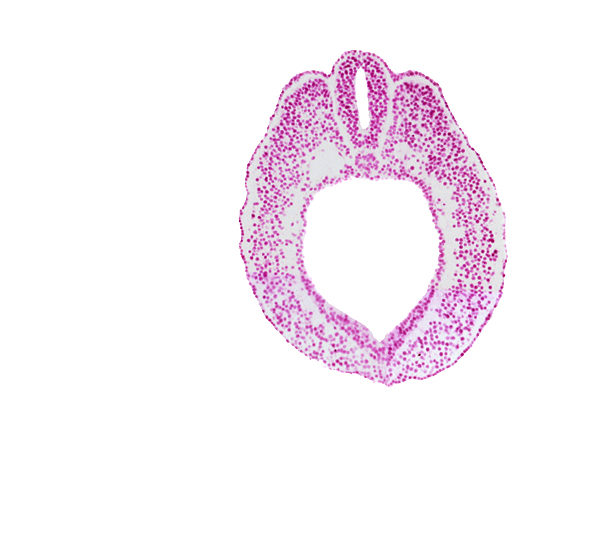 cloacal part of hindgut, dorsal aorta, dorsal aorta plexus, endoderm, lateral mesoderm, notochord, paraxial mesoderm, spinal part of neural tube