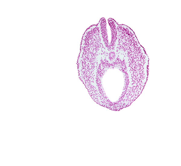 cloacal part of hindgut, dorsal aorta plexus, neural fold, neural groove, notochord, paraxial mesoderm, tangentially cut endoderm