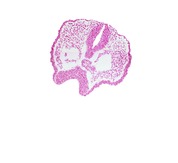 artifact space(s), cephalic end of notochord, chiasmatic plate (D1), dorsal aorta, ectodermal ring, edge of foregut endoderm, floor plate of neural folds, neural fold [diencephalon (D1)], neural groove, rhombencephalon (Rh. 2), surface ectoderm, trigeminal neural crest (CN V)