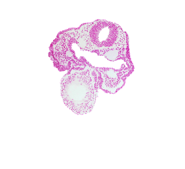 cardiac jelly, dorsal aorta, ectodermal ring, epimyocardium, mandibular prominence of pharyngeal arch 1, notochord, rhombencephalon (Rh. 3), surface ectoderm