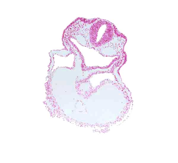 cardiac jelly, caudal part of thyroid diverticulum, dorsal aorta, endoderm, lateral pharyngeal recess, otic placode, pericardial cavity, rhombencephalon (Rh. 5), right ventricle