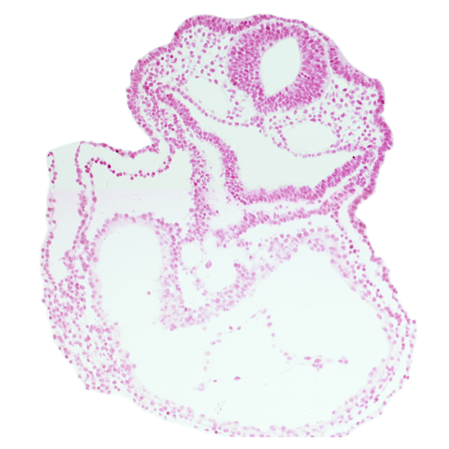 amnion attachment, cardiac jelly, cephalic part of laryngotracheal groove, dorsal aorta, epimyocardium, foregut, head fold region, lateral pharyngeal recess, mesocardium, notochord, otic placode, pericardial cavity, rhombencephalon (Rh. 5)