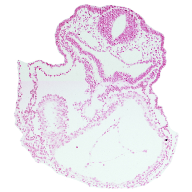 amnion attachment, cardiac jelly, caudal part of right ventricle (epimyocardium), foregut, laryngotracheal groove, lateral pharyngeal recess, left ventricle, otic placode, pericardial cavity, rhombencephalon (Rh. 5), surface ectoderm