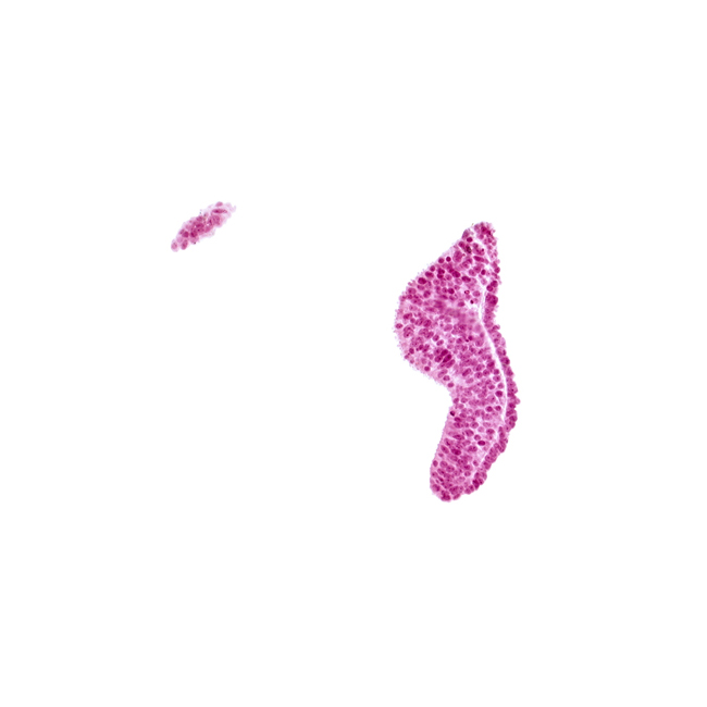 cephalic neuropore, neural fold [diencephalon (D1)], neural fold [diencephalon (D2)], optic sulcus, surface ectoderm, tangentially cut surface ectoderm (right side)