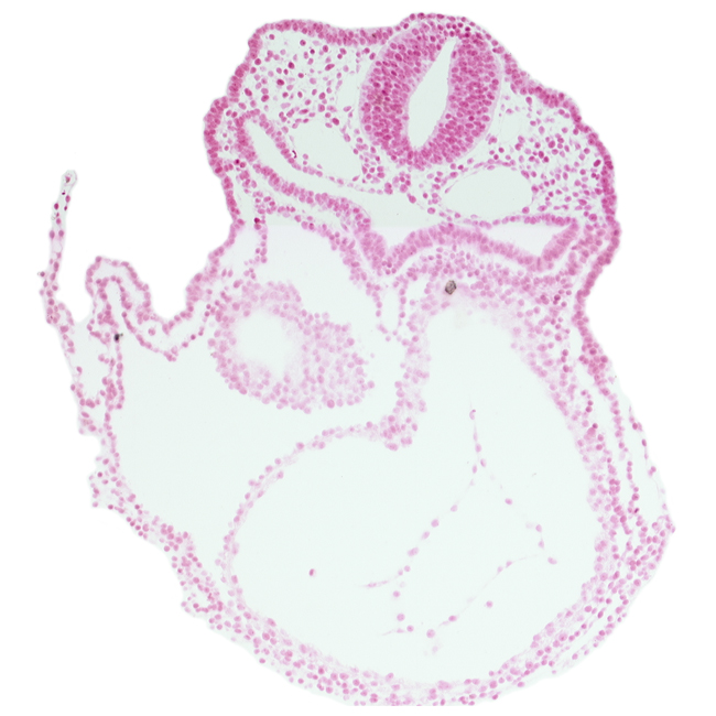 caudal edge of otic placode, cephalic part of right atrium, dorsal aorta, edge of atrioventricular canal, head mesenchyme, lateral pharyngeal recess, left ventricle, notochord, pericardial cavity, primary head vein, respiratory primordium