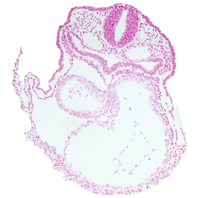 cardiac jelly, dorsal aorta, edge of atrioventricular canal, foregut, glossopharyngeal neural crest (CN IX), head mesenchyme, left ventricle, pericardial cavity, precardinal vein, respiratory primordium, rhombencephalon (Rh. 6), right atrium