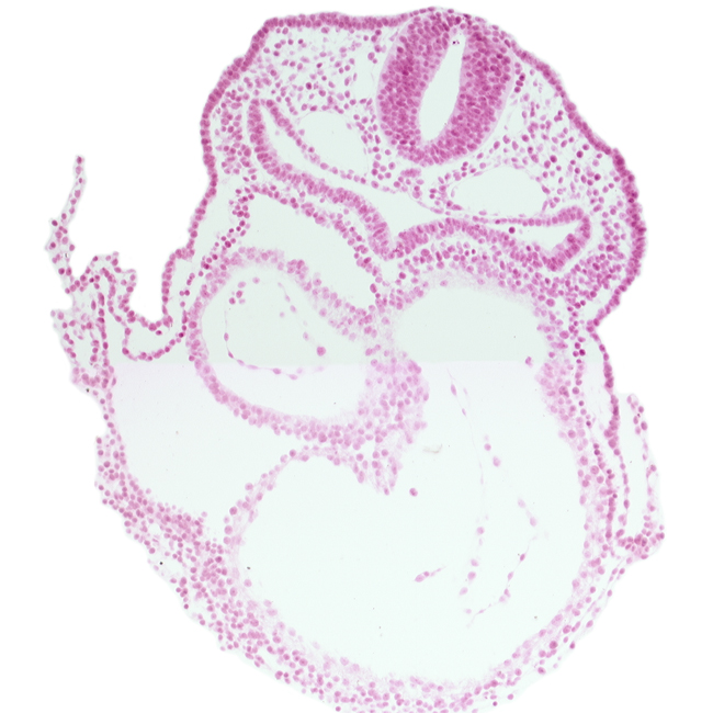 amnion attachment, cephalic part of atrioventricular canal, dorsal aorta, glossopharyngeal neural crest (CN IX), lateral pharyngeal recess, left ventricle, pericardial cavity, precardinal vein, respiratory primordium, rhombencephalon (Rh. 6), right atrium