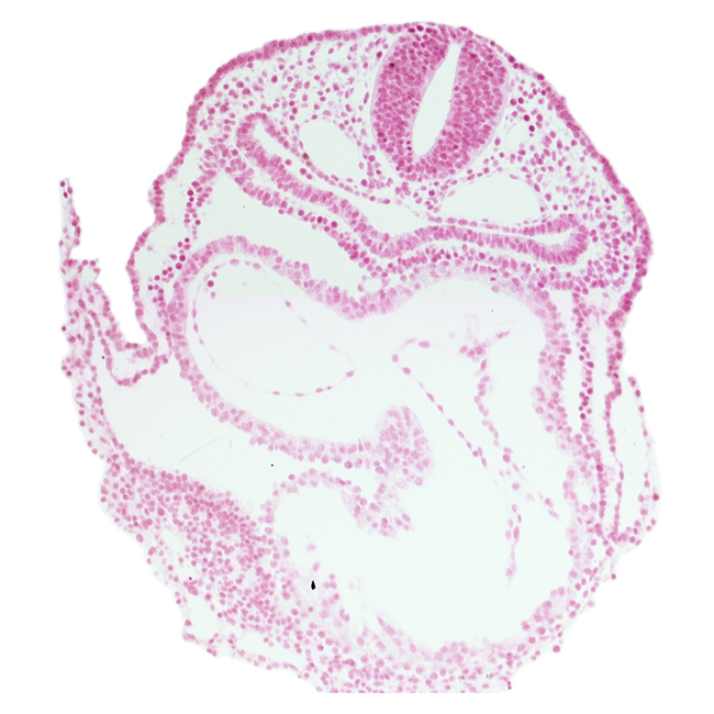 amnion attachment, atrioventricular junction, caudal part of left ventricle, endoderm, foregut, head mesenchyme, lateral pharyngeal recess, left atrium, pericardial cavity, precardinal vein, rhombencephalon (Rh. 7), right atrium, surface ectoderm