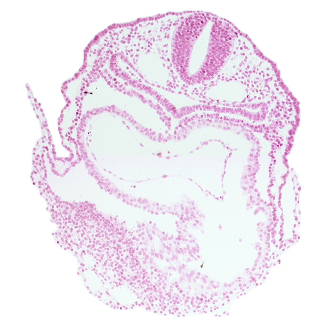 amnion attachment, caudal part of left ventricle, cephalic edge of interatrial foramen (primum), dorsal aorta, left atrium, mesocardium, pericardial cavity, rhombencephalon (Rh. 7), right atrium, vagal neural crest (CN X)