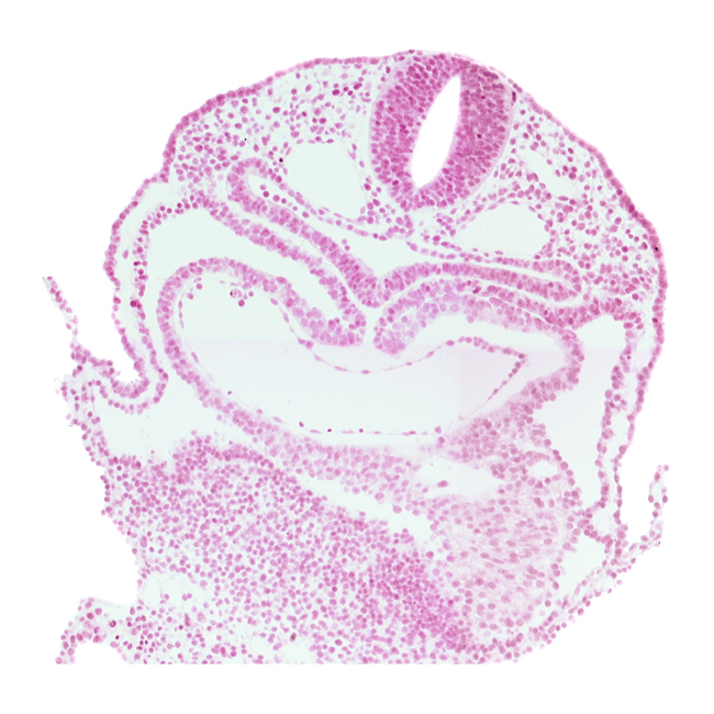 caudal part of left ventricle, dorsal aorta, interatrial foramen (primum), left atrium, precardinal vein, right atrium, umbilical vesicle wall