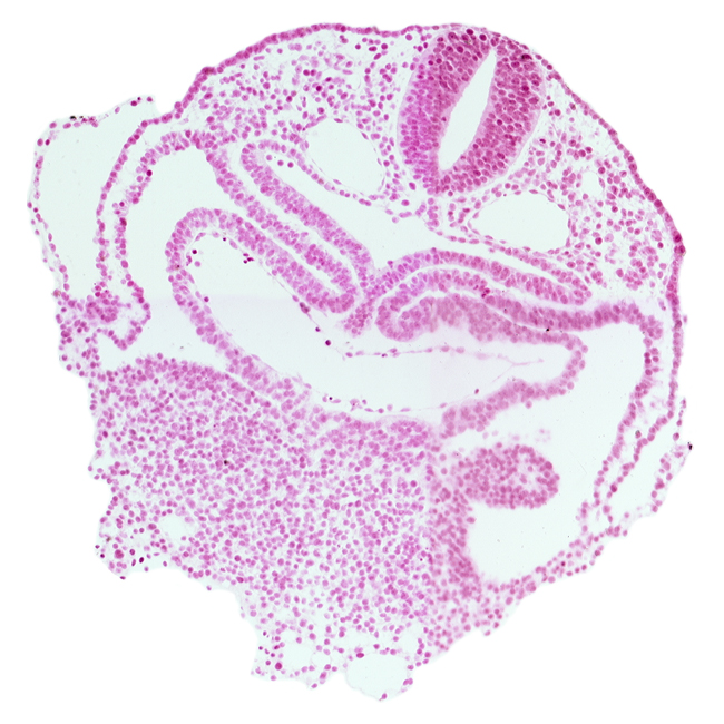 amnion attachment, caudal part of interatrial foramen (primum), cephalic edge of hepatic plate, dorsal aorta, left atrium, neural tube, notochordal plate, pericardial cavity, precardinal vein, right atrium, septum transversum