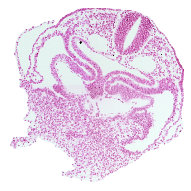 amnion attachment, cephalic edge of dermatomyotome 1 (O-1), course of common cardinal vein, hepatic plate, hypoglossal neural crest (CN XII), left horn of sinus venosus, pericardial cavity, precardinal vein, rhombencephalon (Rh. D), right horn of sinus venosus, septum transversum, umbilical vesicle wall