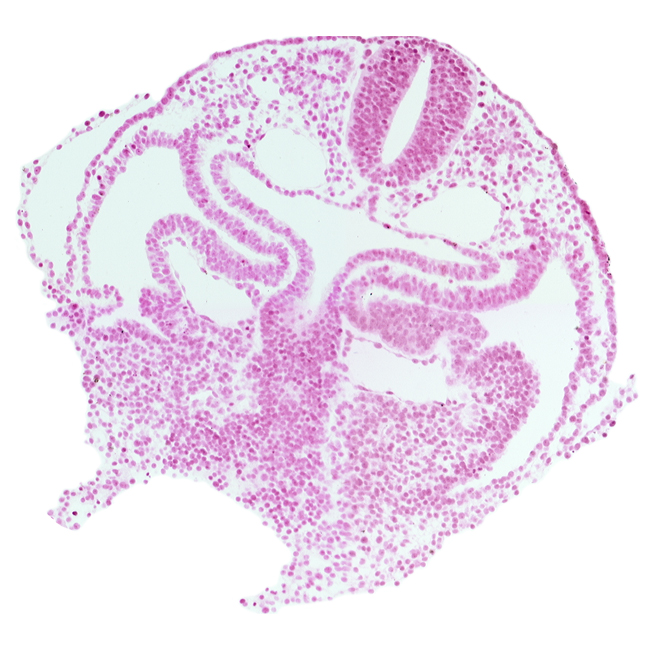 caudal part of foregut, cephalic part of pericardioperitoneal canal (pleural cavity), course of common cardinal vein, dermatomyotome 1 (O-1), endoderm, hepatic plate, hypoglossal neural crest (CN XII), left horn of sinus venosus, neural tube, pericardial cavity, primordial hepatic antrum, rhombencephalon (Rh. D), right horn of sinus venosus, sclerotome, septum transversum, umbilical vesicle wall