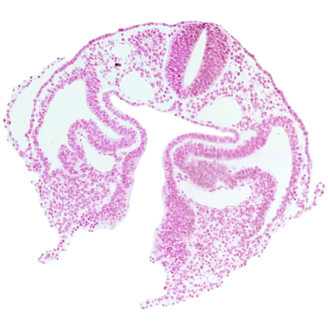 amnion attachment, cephalic intestinal portal, dermatomyotome 1-2 intersegmental region, dorsal aorta, junction of foregut and midgut, left horn of sinus venosus, notochordal plate, pericardioperitoneal canal (pleural cavity), postcardinal vein, rhombencephalon (Rh. D), right horn of sinus venosus, septum transversum, umbilical vesicle stalk lumen, umbilical vesicle wall