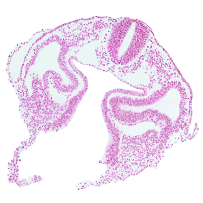 amnion attachment, cephalic edge of dermatomyotome 2 (O-2), dorsal aorta, dorsal intersegmental artery, junction of common cardinal veins, left horn of sinus venosus, midgut, notochord, pericardioperitoneal canal (pleural cavity), rhombencephalon (Rh. D), right horn of sinus venosus, sclerotome