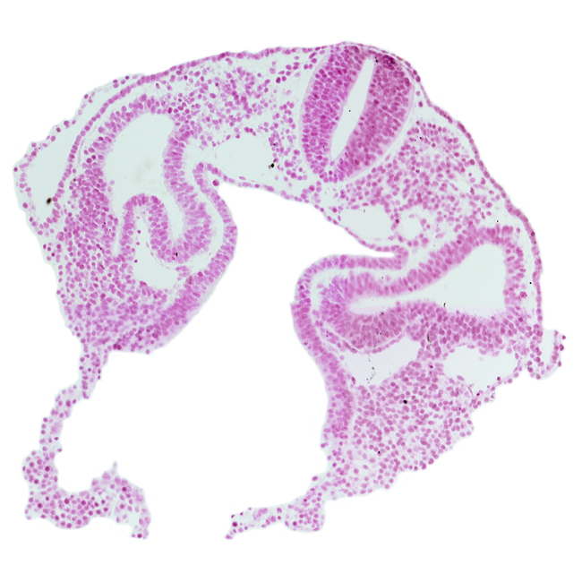 amnion attachment, dermatomyotome 2 (O-2) , left horn of sinus venosus, midgut, notochord, peritoneal cavity (coelom), postcardinal vein, rhombencephalon (Rh. D), sclerotome, umbilical vesicle wall