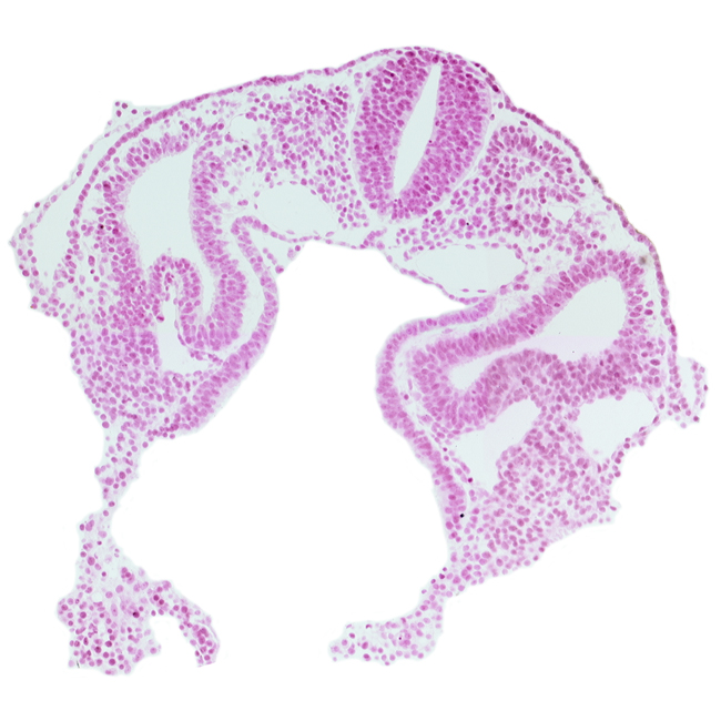 dermatomyotome 2 (O-2) , hypoglossal neural crest (CN XII), left horn of sinus venosus, midgut, notochord, postcardinal vein, rhombencephalon (Rh. D), sclerotome