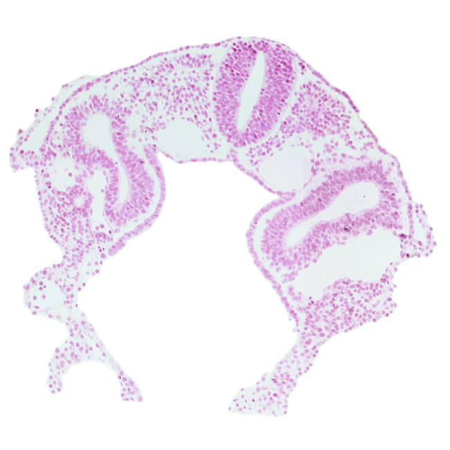 amnion attachment, dermatomyotome 2 (O-2) , dorsal aorta, hypoglossal neural crest (CN XII), left horn of sinus venosus, midgut, peritoneal cavity (coelom), postcardinal vein, rhombencephalon (Rh. D), sclerotome, somatopleure, splanchnopleure