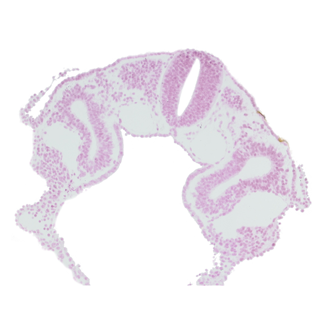 amniotic cavity, caudal edge of dermatomyotome 2 (O-2), dorsal intersegmental artery, left horn of sinus venosus, midgut, notochord, peritoneal cavity (coelom), postcardinal vein