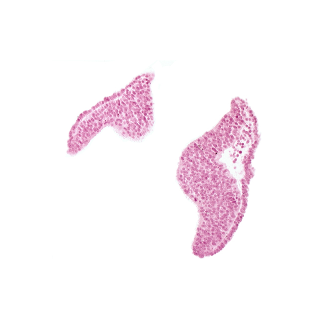 artifact space(s), cephalic neuropore, cephalic part of neural fold [diencephalon (D1)], junction of neural ectoderm and surface ectoderm, neural fold [diencephalon (D1)], neural fold [diencephalon (D2)], neural fold [mesencephalon (M)], optic nerve primordium (CN II) [diencephalon (D1)], optic sulcus, surface ectoderm