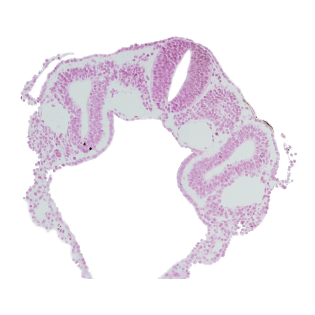 dermatomyotome 3 (O-3) , dorsal aorta, hypoglossal neural crest (CN XII), left horn of sinus venosus, midgut, neural tube, peritoneal cavity (coelom), postcardinal vein, rhombencephalon (Rh. D)