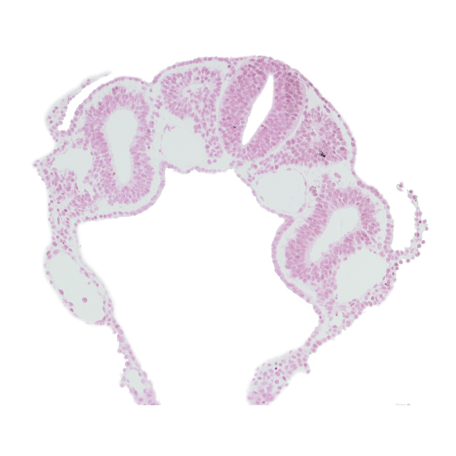 amniotic cavity, dermatomyotome 3 (O-3) , dorsal aorta, endoderm, left horn of sinus venosus, midgut, right vitelline (omphalomesenteric) vein, sclerotome, somatopleuric mesoderm, splanchnopleuric mesoderm