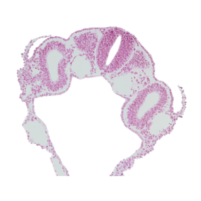 amnion attachment, caudal edge of dermatomyotome 3 (O-3), dorsal aorta, endoderm, hypoglossal neural crest (CN XII), left horn of sinus venosus, midgut, notochord, peritoneal cavity (coelom), rhombencephalon (Rh. D), umbilical vesicle wall, vitelline (omphalomesenteric) vein