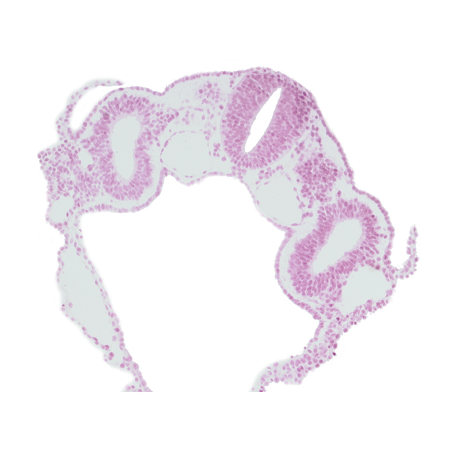 amnion attachment, caudal part of left horn of sinus venosus, cephalic edge of dermatomyotome 4 (O-4), dorsal aorta, midgut, neural tube, notochord