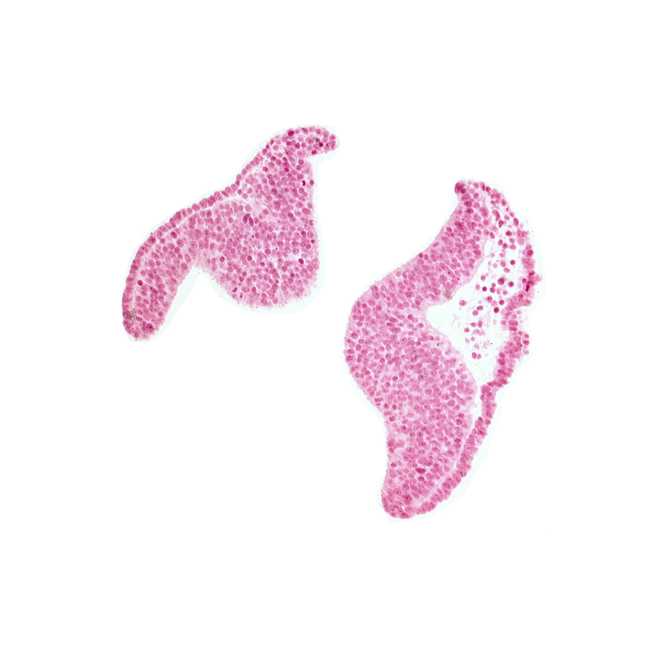 cephalic neuropore, junction of neural ectoderm and surface ectoderm, neural fold [diencephalon (D1)], neural fold [diencephalon (D2)], neural fold [mesencephalon (M)], optic nerve primordium (CN II) [diencephalon (D1)], optic sulcus