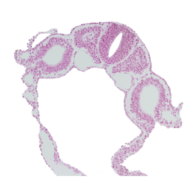 amnion attachment, communication between peritoneal cavity and extra-embryonic coelom, dermatomyotome 4 (O-4) , dorsal aorta, hypoglossal neural crest (CN XII), midgut, notochord, peritoneal cavity, rhombencephalon (Rh. D), right umbilical vein, right vitelline (omphalomesenteric) vein, umbilical vesicle wall