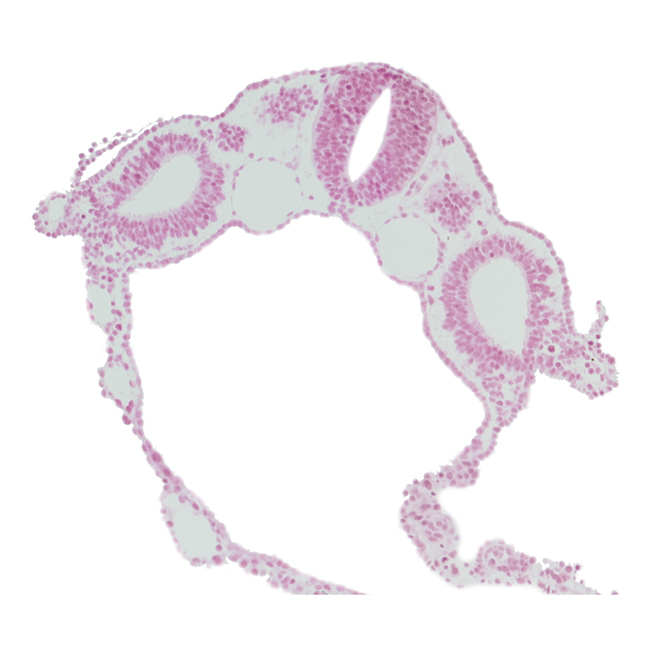 cephalic edge of dermatomyotome 5 (C-1), dorsal aorta, endoderm, extra-embryonic coelom, junction of rhombencephalon and spinal cord, neural tube, peritoneal cavity (coelom), surface ectoderm