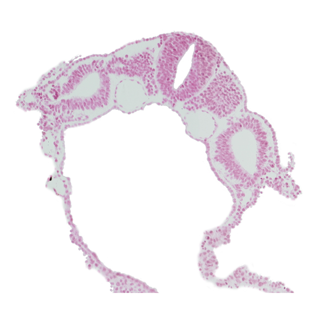 amnion attachment, dermatomyotome 5 (C-1), dorsal aorta, midgut, neural crest, peritoneal cavity (coelom), spinal part of neural tube, sulcus limitans, umbilical vesicle cavity, vitelline (omphalomesenteric) vein