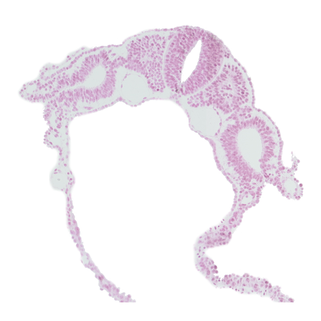 communication between peritoneal cavity and extra-embryonic coelom, dermatomyotome 5 (C-1), intermediate mesenchyme, peritoneal cavity (coelom), somatopleuric mesoderm, somitocoel 5, spinal part of neural tube, splanchnopleuric mesoderm