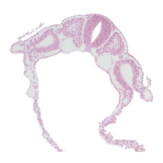 communication between peritoneal cavity and extra-embryonic coelom, dermatomyotome 5 (C-1), dorsal aorta, endoderm, intermediate mesenchyme, midgut, notochord, sclerotome, somitocoel 5, spinal part of neural tube, surface ectoderm