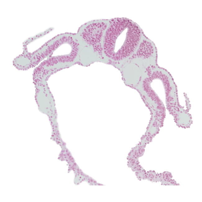 amnion attachment, caudal part of dermatomyotome 5 (C-1), communication between peritoneal cavity and extra-embryonic coelom, intermediate mesenchyme, left umbilical vein, neural crest, notochord, right umbilical vein, spinal part of neural tube, sulcus limitans, vitelline (omphalomesenteric) vein