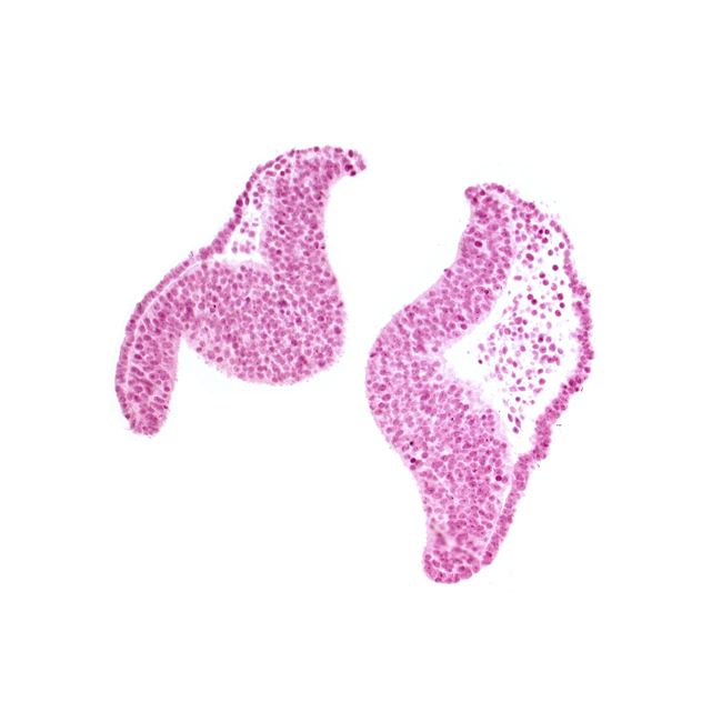 artifact space(s), cephalic neuropore, neural fold [diencephalon (D1)], neural fold [diencephalon (D2)], neural fold [mesencephalon (M)], optic nerve primordium (CN II) [diencephalon (D1)], optic sulcus