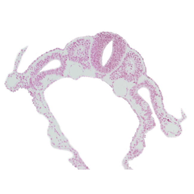 communication between peritoneal cavity and extra-embryonic coelom, dermatomyotome 6 (C-2), dorsal aorta, endoderm, midgut, notochord, somitocoel 6, spinal part of neural tube, surface ectoderm