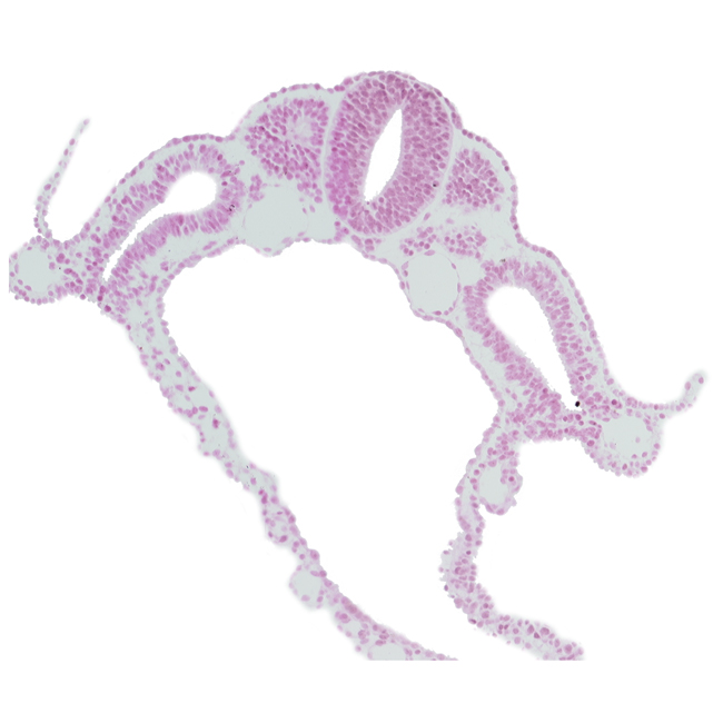 amnion attachment, caudal part of dermatomyotome 6 (C-2), left umbilical vein, midgut, neural tube, right umbilical vein, sclerotome of dermatomyotome 7 (C-3), sulcus limitans