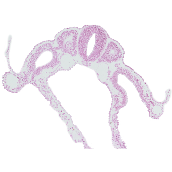 communication between peritoneal cavity and extra-embryonic coelom, dermatomyotome 7 (C-3), neural tube, right umbilical vein, sclerotome, somitocoel 7, surface ectoderm